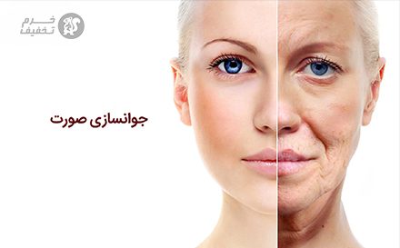 لیفت صورت با نخ جوانساز در کلینیک نویان